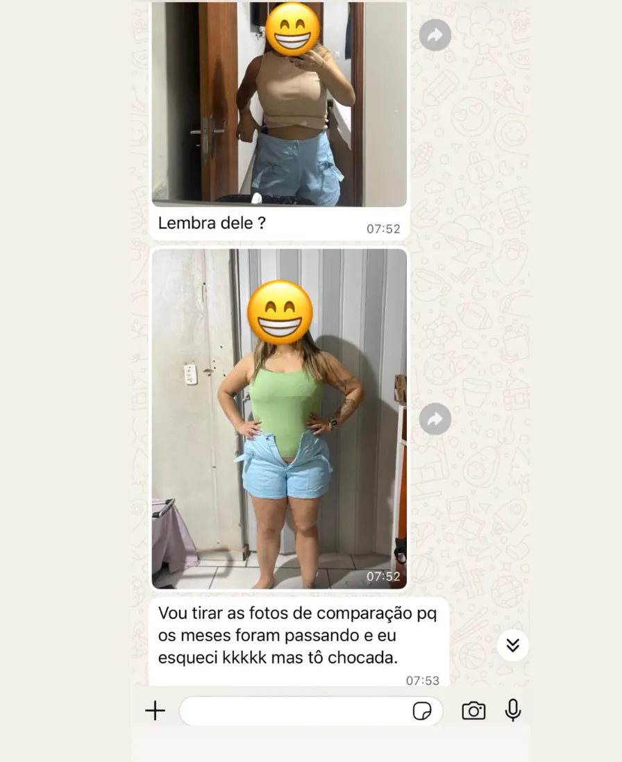 Print de conversa no WhatsApp: duas fotos de uma paciente, com o rosto coberto por emoji, comparando o caimento de um short.